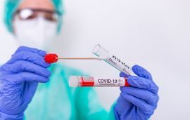 На утро 19 мая в Саратовской области зарегистрировали 48 новых случаев заболевания жителей коронавирусом
