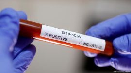 На 20 июля в области зарегистрировано 65 новых случаев заболевания коронавирусом