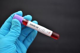На 15 июля в области зарегистрировано 53 новых случая заболевания коронавирусом
